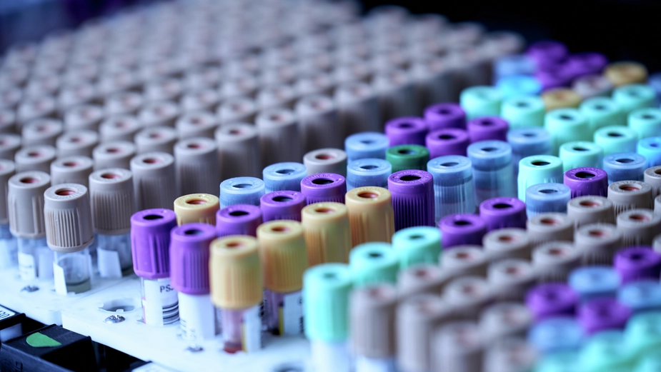 Laboratory sample tubes highlighting DP World’s role in healthcare logistics